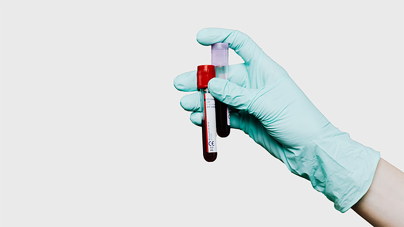 Healthy Lipid Levels